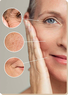 Non-Ablative Fractional Laser