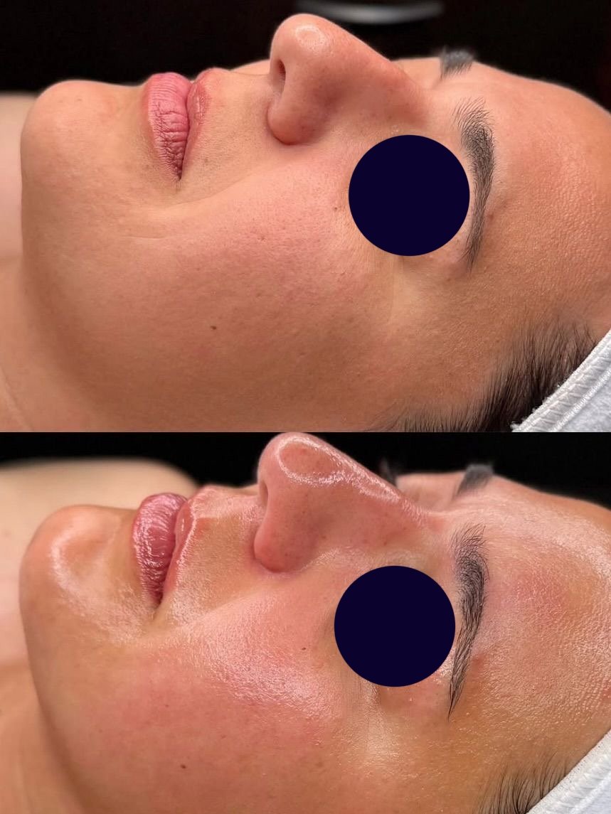 Hydro before after 23