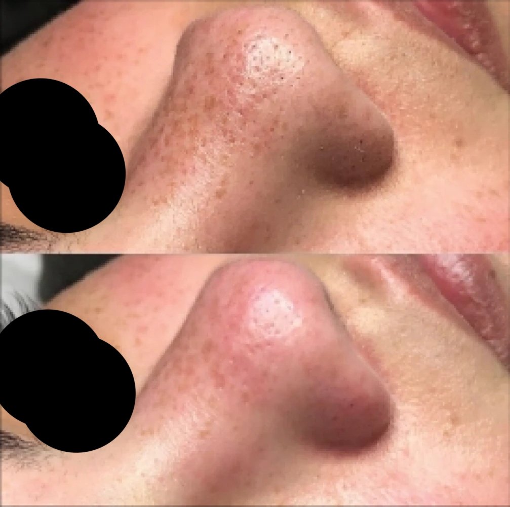 Hydro before afterr