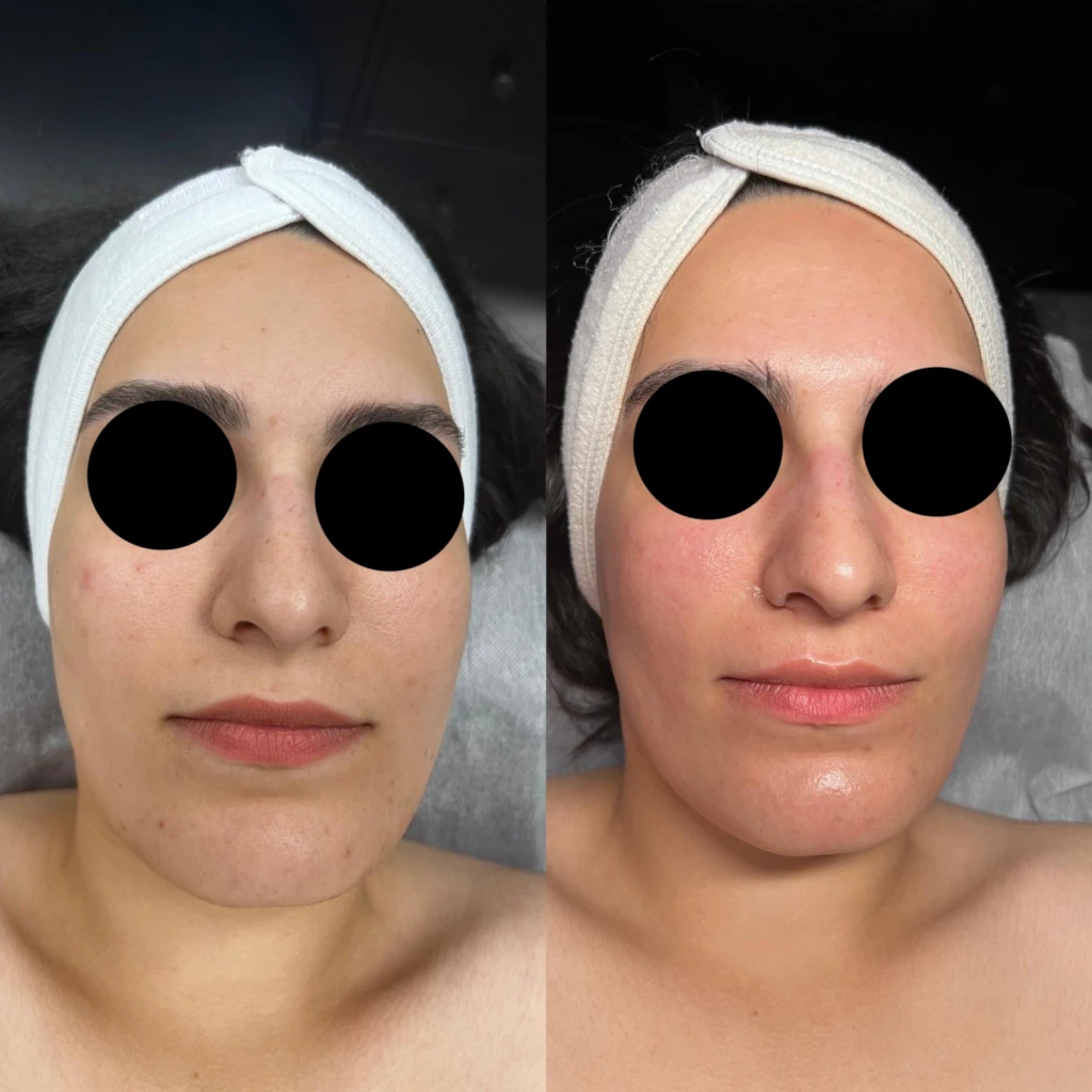 chemical-before-after23 (1)
